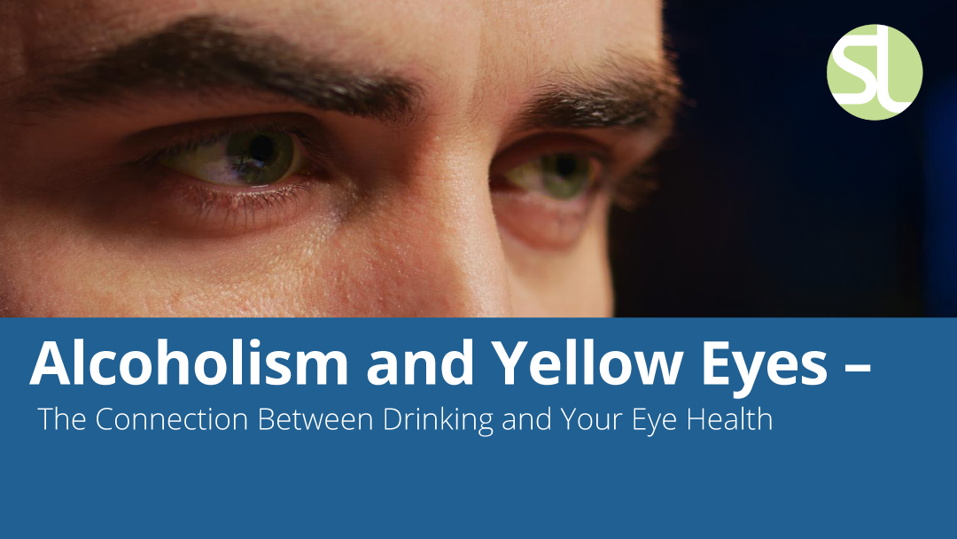 do cigarettes make your eyes yellow Alcoholism and Yellow Eyes – The Connection Between Drinking and Your Eye Health do cigarettes make your eyes yellow Alcoholism and Yellow Eyes – The Connection Between Drinking and Your Eye Health